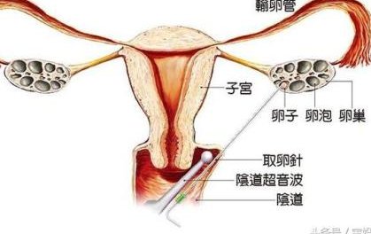 国内第三代试管婴儿医院哪家成功率较高？