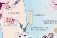 辽宁十大试管医院中排名靠前的三甲医院有哪些？