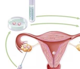 国内试管生孩子价格明细一览，国内外试管费用差异解析